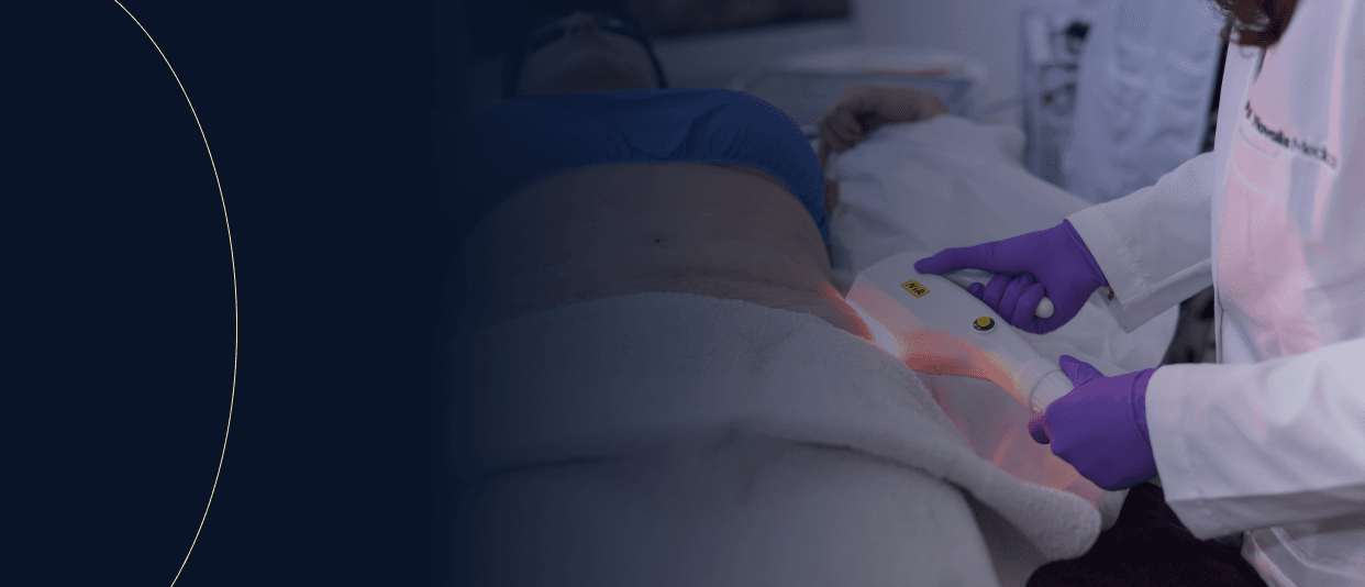 Zona abdomen y caderas